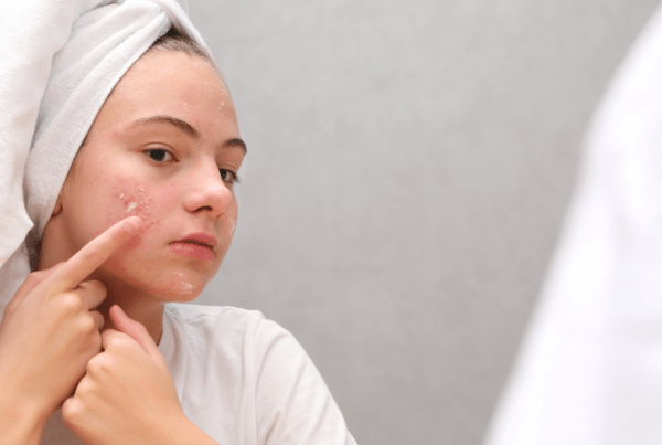 rutina skincare durante la adolescencia