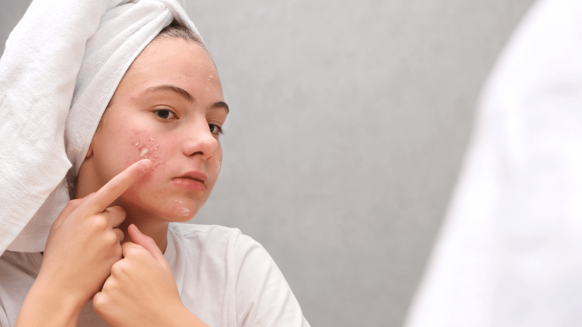 Skin care en adolescentes: Crea la rutina perfecta | Blog de Belleza