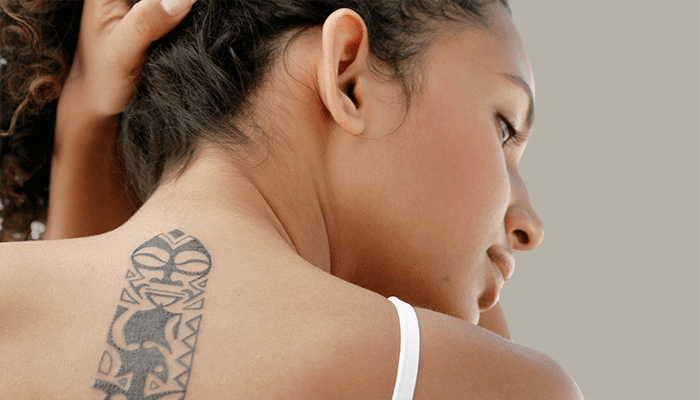 eliminacion de tatuajes con laser despigmentante Enlighten